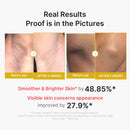 Shot Esfoliante Corporal Kojic e Cúrcuma - brazilcosmeticos.com