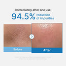 Óleo de Limpeza Cravos Zero Pore