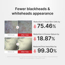 Shot Esfoliante Rice de Ácido Hipocloroso - brazilcosmeticos.com