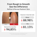 Shot Esfoliante Corporal Rice de Ácido Hipocloroso - brazilcosmeticos.com
