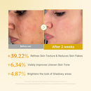 Tônico Kojic e Cúrcuma - brazilcosmeticos.com