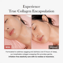 Tratamento Labial de Colágeno
