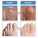 Dispositivo de LED U.V Funcional Para Unhas