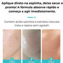 Secativo de Espinhas em Gel - Fórmula Asiática com Ácido Salicílico