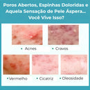 Secativo de Espinhas em Gel - Fórmula Asiática com Ácido Salicílico