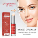 Retinol Para Área dos Olhos – Reduz Olheiras, Bolsas e Linhas Finas