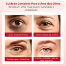 Retinol Para Área dos Olhos – Reduz Olheiras, Bolsas e Linhas Finas