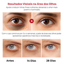 Retinol Para Área dos Olhos – Reduz Olheiras, Bolsas e Linhas Finas